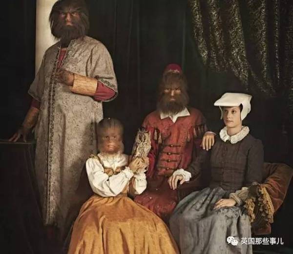 《美女与野兽》竟然是真的！背后是一段暗黑又心酸的真实故事…
