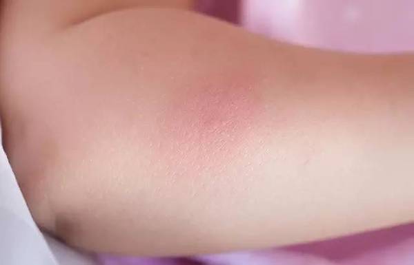 她把香蕉涂在脸上，竟然变成这样…神奇！