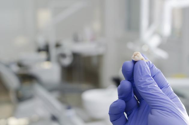 科学家开发“牙齿粉碎机”：获取智齿中的干细胞
