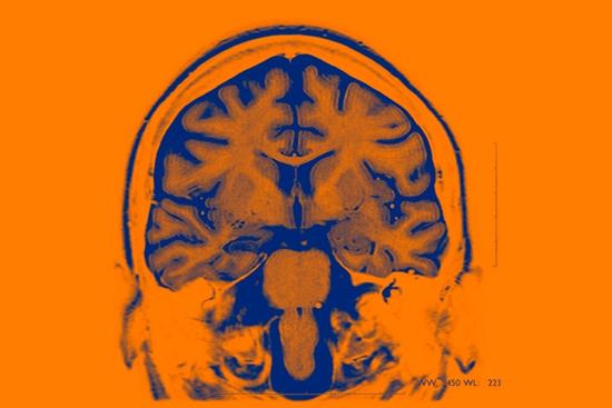最新研究：用AI控制的大脑植入物治疗精神疾病
