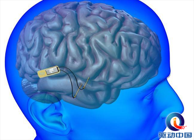 美国神经科学学会：AI控制人脑植入物完成初步人体测试！