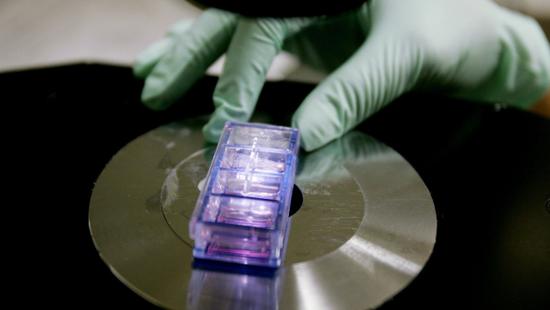 新型基因疗法可对艾滋病病毒有长期免疫力