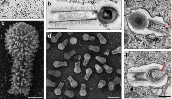新发现的巨大病毒正挑战我们对病毒的认知
