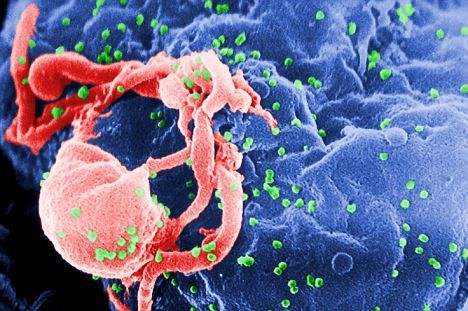 人类首次视频记录 HIV 感染免疫细胞全过程