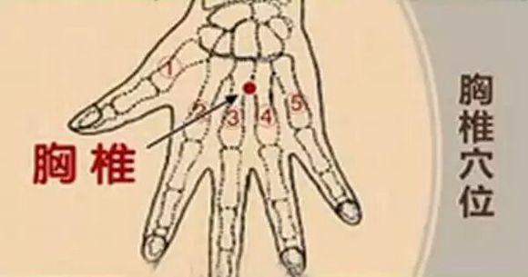 几分钟治好腰、颈、胸椎病