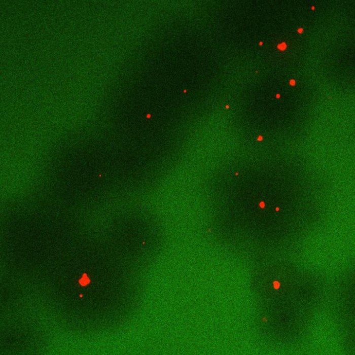 科学家发现可以用噬菌体杀死抵抗抗生素的细菌
