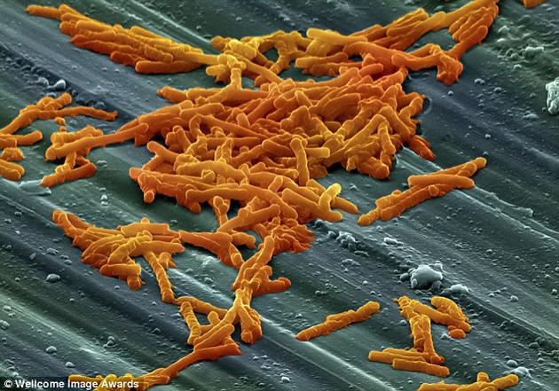 专家称30年后超级病菌将比癌症和糖尿病更为致命