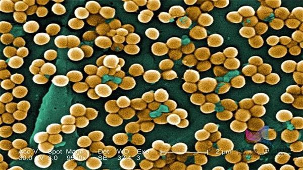 还在滥用抗生素？30年后每年或有1000万人因它而死