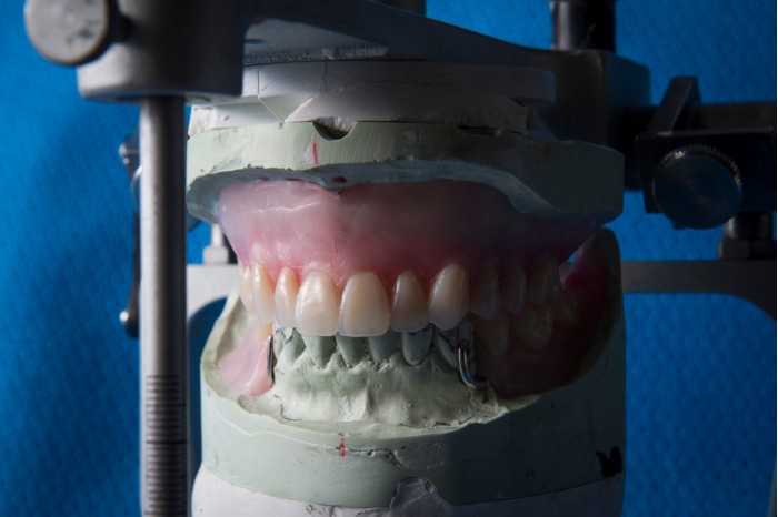 德克萨斯州开始使用3D打印技术为犯人制作假牙