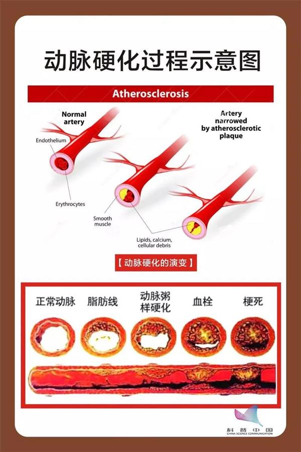 吃盐越少就越健康？未必，盲目低盐有隐患