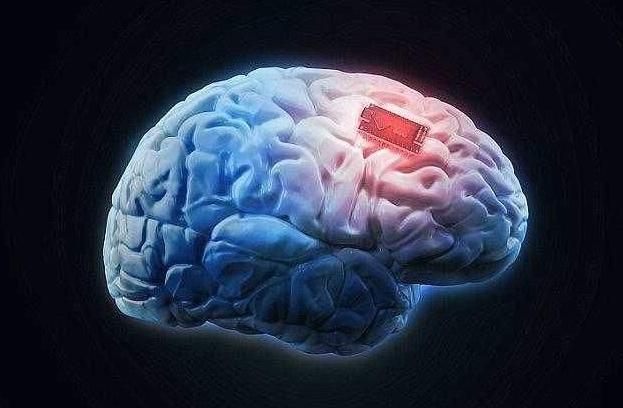 大脑植入微芯片 未来五年人类可实现“超智能”