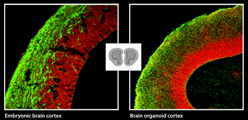 科学家培育出“迷你”大脑 可控制肌肉收缩