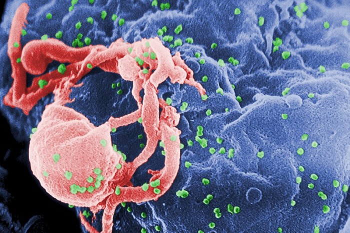 艾滋病是否能够治愈 “伦敦病人” 可复制吗？