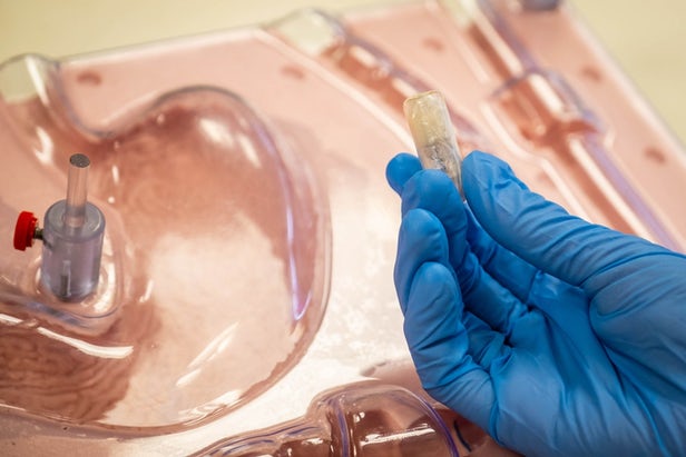 新加坡科学家研发可充气的减肥胶囊 可由磁铁激活