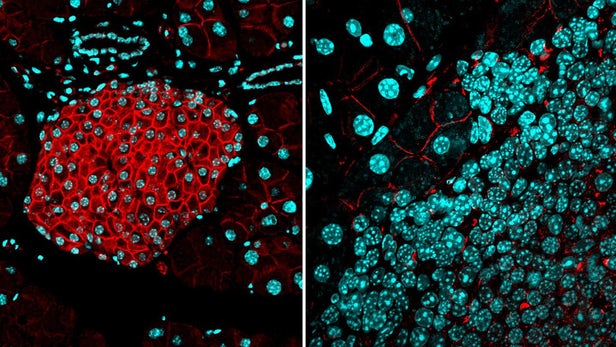 研究人员发现生物“屏障”可以防止癌细胞转移
