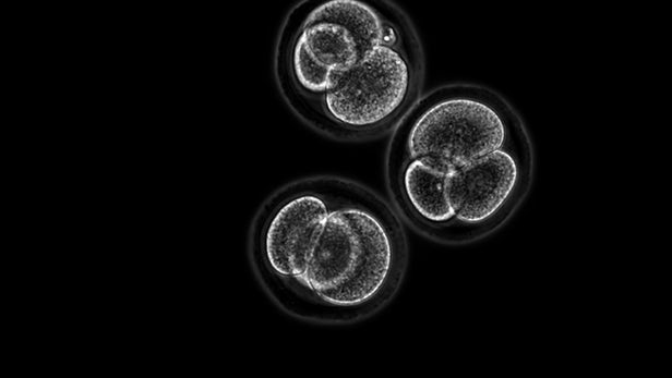 以色列科学家在干细胞研究中取得突破 让人造胚胎成为可能