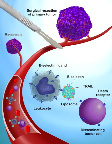 纳米粒子有助于免疫细胞更有效地寻找和摧毁“流氓”癌细胞