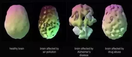 污染的空气进入大脑后 我们越来越焦虑