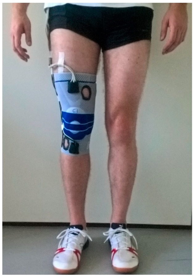 研究人员打造“智能”绷带：能实时监测关节炎患者膝盖张力情况