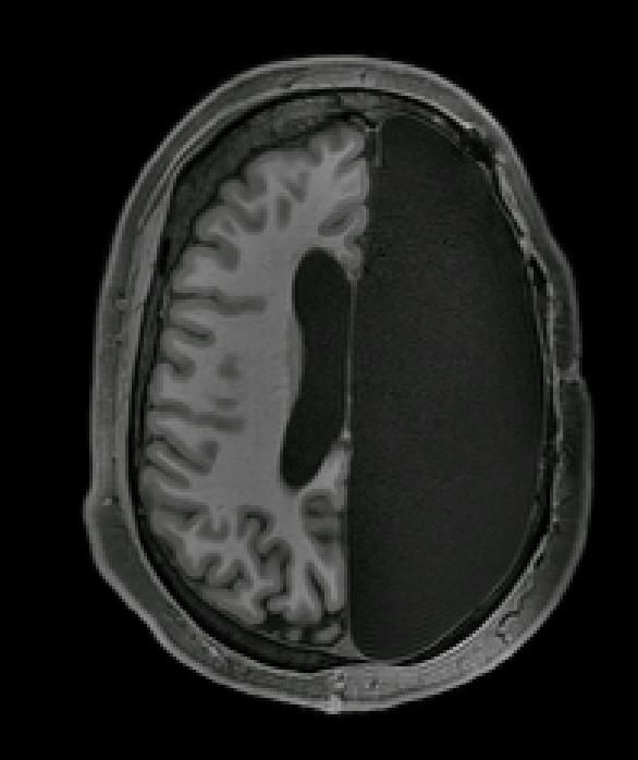 2019年十项重要的大脑研究：脑脊液可清除有毒蛋白质