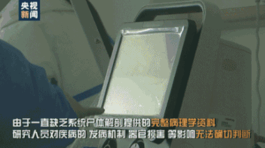 “肺已经不是肺了”，首例新冠肺炎尸检报告发布