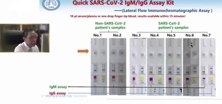 钟南山团队发表肺炎检测新成果：IgM 检测试纸、恒温扩增芯片