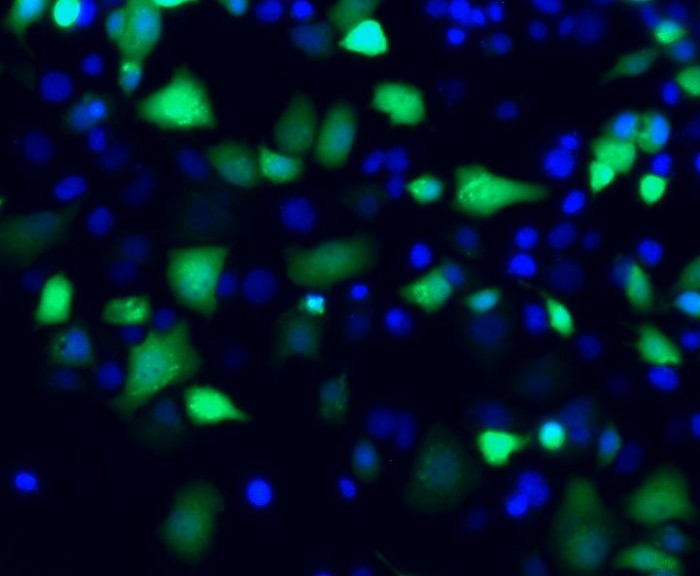 离治愈更进一步 科学家发现感染乙肝必要因素