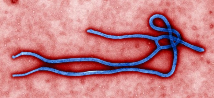 科学家开发出新埃博拉病毒疫苗：对所有种类都有效