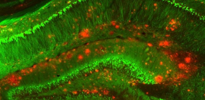 科学家设计出新型抗体 有望为监测阿尔茨海默病有毒蛋白提供新视角