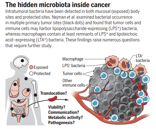 人类肿瘤里发现大量细菌！它们究竟在做什么？