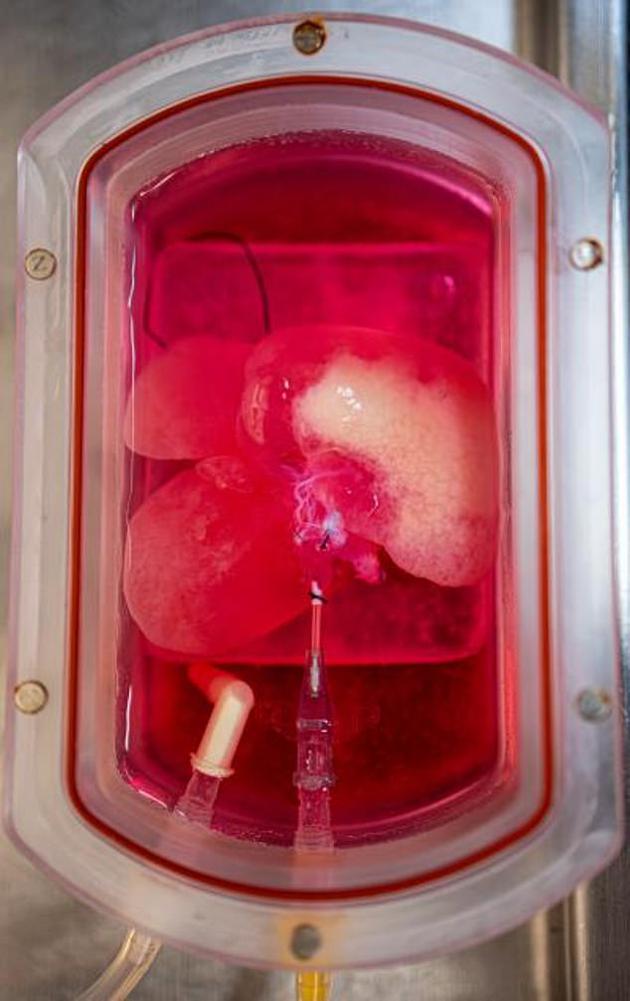 “定制器官”有希望了 皮肤细胞培育出微型人类肝脏