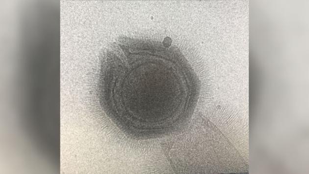 巨型病毒是如何释放DNA物质感染细胞的？
