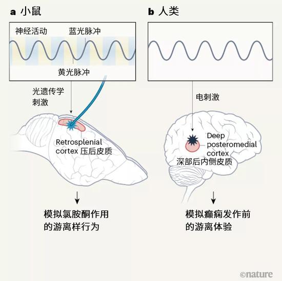 “灵魂出窍”是什么体验？Nature论文找到其中关键