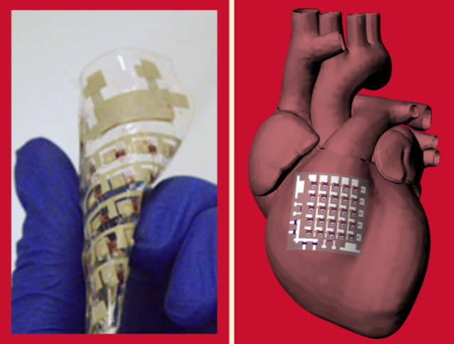 科学家开发自供电贴片 可监测和治疗受损的心脏
