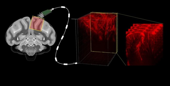 用超声波“读心”：加州理工学院科学家展示新型脑机接口技术