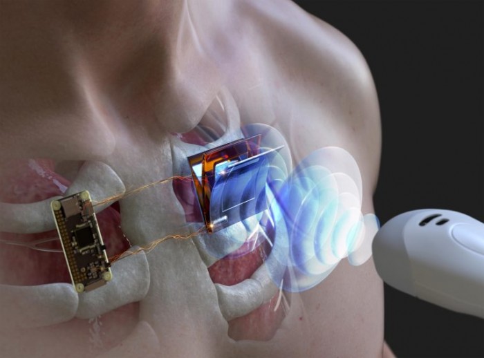 科学家利用超声波为水下和人体植入式电子设备充电