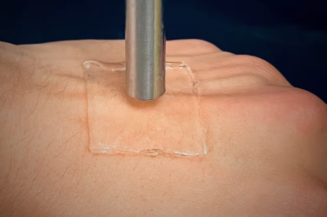 科学家开发水凝胶绷带 利用超声波更好地粘附在皮肤上