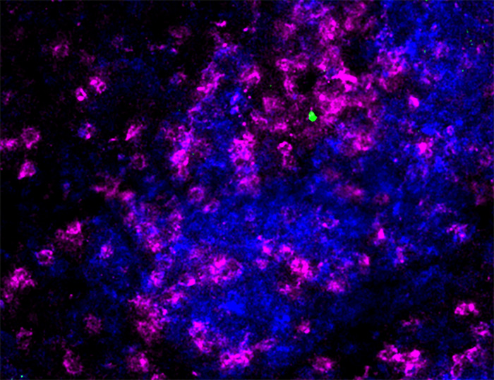 研究：T细胞再生分子或成为预防免疫衰竭的关键