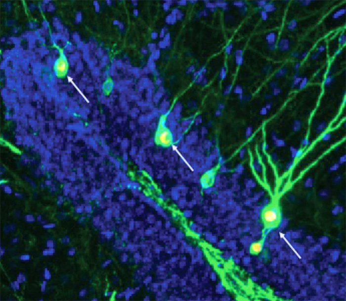 研究：促进神经元的形成可以帮助恢复阿尔茨海默病的记忆