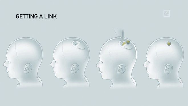 专访清华大学脑机接口科研团队负责人：中美“脑机接口”下一突破是什么？